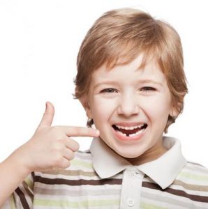 Kind mit Zahnlücke
